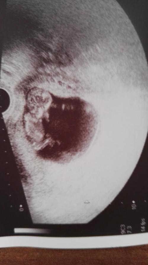 bb6961588eb29298med.jpg